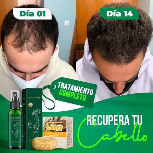 OUHOE-SPRAY ORIGINAL PARA CAIDA DE CABELLO